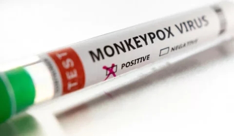 Segundo caso de varíola dos macacos é confirmado em São Paulo