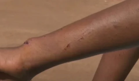 Madrasta é presa suspeita de agredir enteada com tábua com pregos