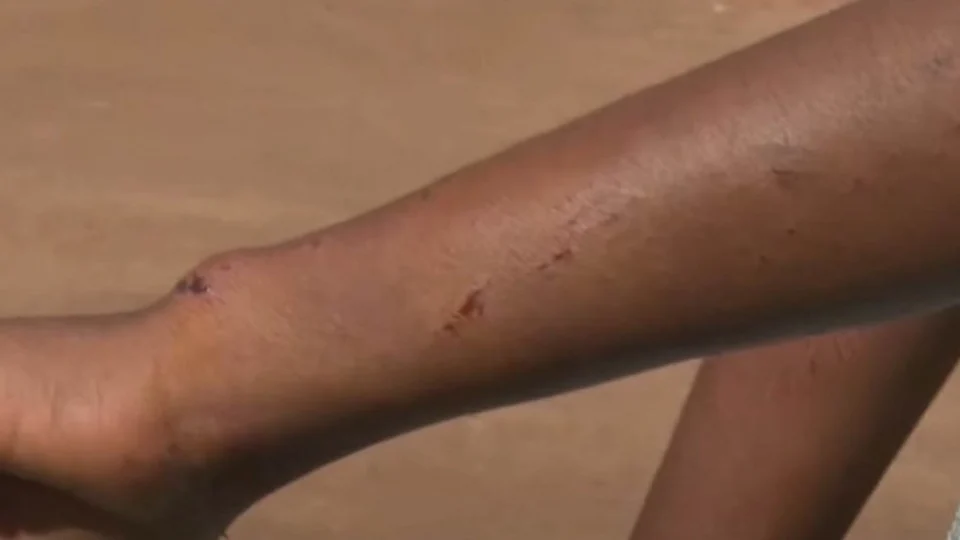 Madrasta é presa suspeita de agredir enteada com tábua com pregos