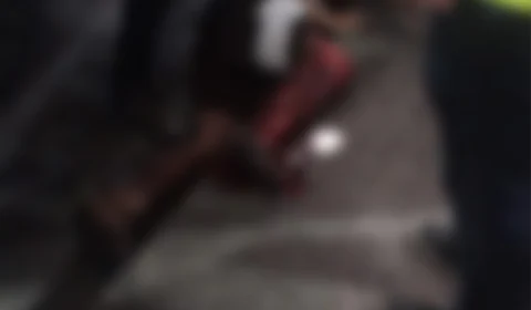 Homem tem a perna esmagada ao ser atropelado por ônibus