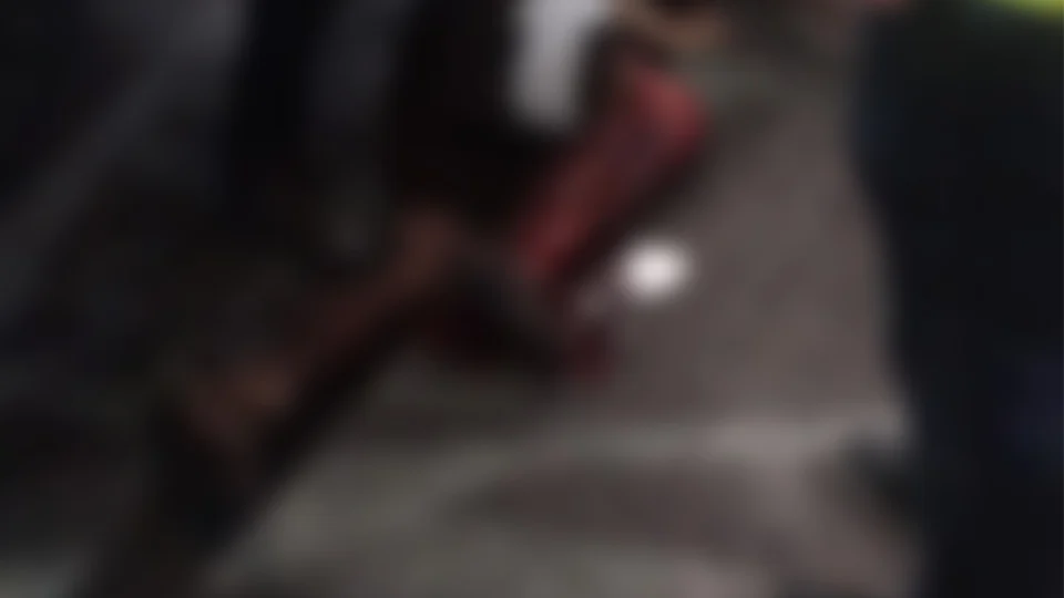 Homem tem a perna esmagada ao ser atropelado por ônibus