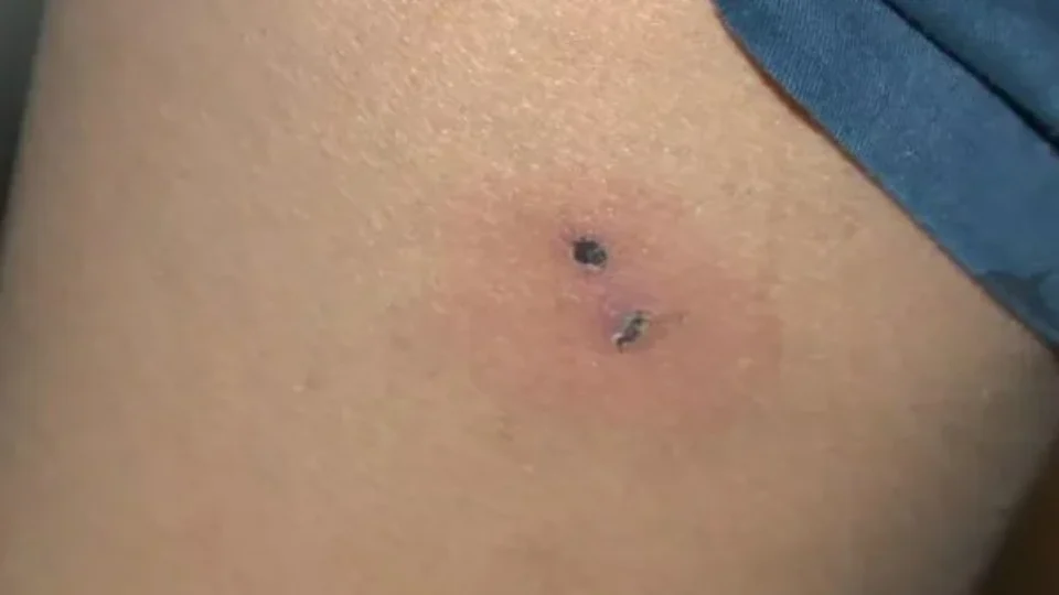 Criança de 9 anos é mordida por rato na escola