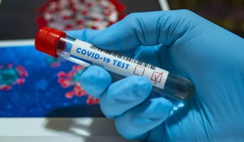 Amazonas registra 382 novos casos de covid-19 nesta quarta-feira