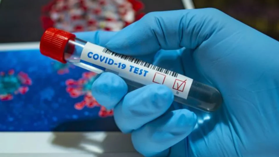 Amazonas registra 382 novos casos de covid-19 nesta quarta-feira