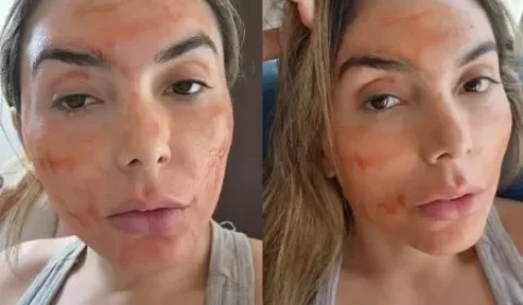 Influenciadora usa sangue menstrual em máscara facial