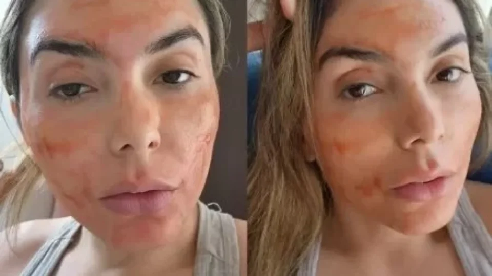 Influenciadora usa sangue menstrual em máscara facial