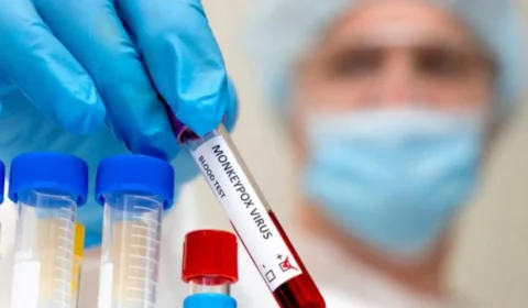 Saiba quadro atual da Covid-19, Monkeypox e vacinação no AM