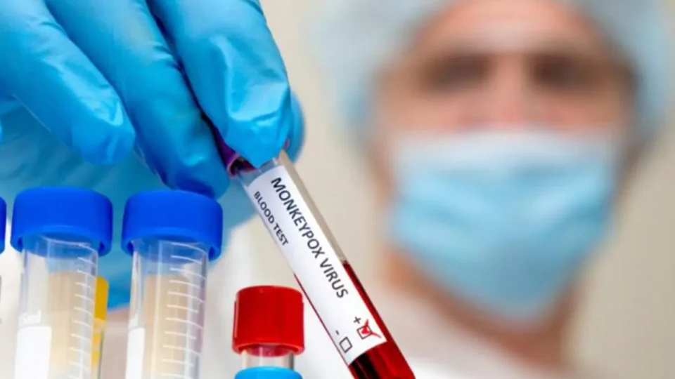 Saiba quadro atual da Covid-19, Monkeypox e vacinação no AM