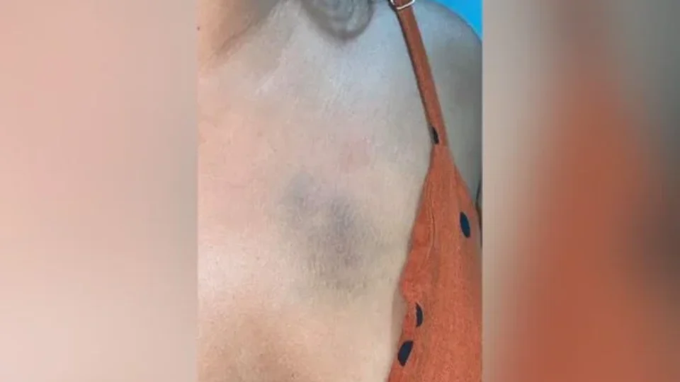 Mulher acusa ex de estupro e agressão: “Enchia minha cara de tapa”