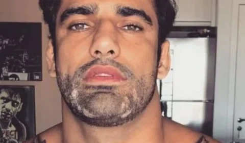 Vídeo chocante mostra resgate de lutador de jiu-jítsu baleado na testa