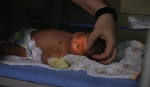 Teste do Olhinho passa a ser obrigatório em maternidades e hospitais públicos e privados no AM