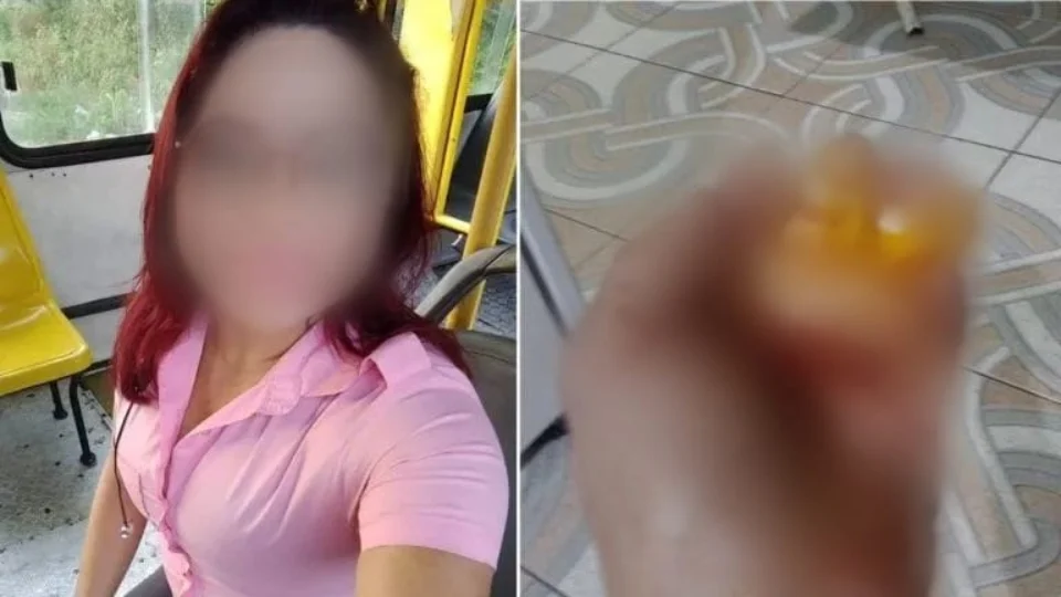 Cobradora de ônibus esfaqueada nas mãos em Manaus divulga seu estado de saúde