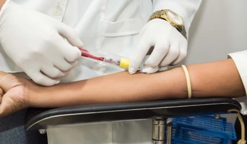 Leucemia é o câncer mais presente na população amazonense