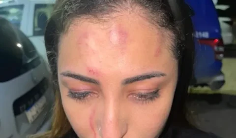 Cantora é espancada por policial militar e a esposa antes de show