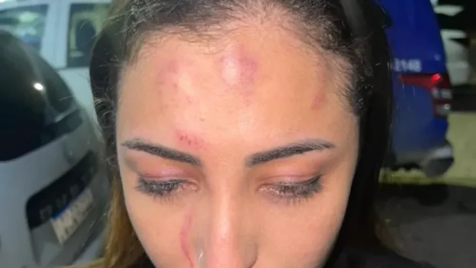 Cantora é espancada por policial militar e a esposa antes de show