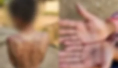 Mãe espanca e queima filho de dez anos