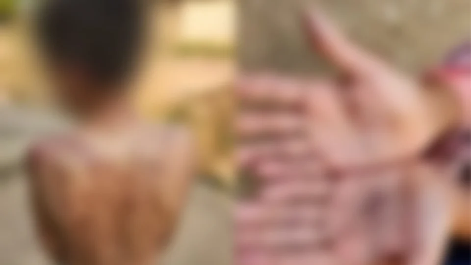 Mãe espanca e queima filho de dez anos