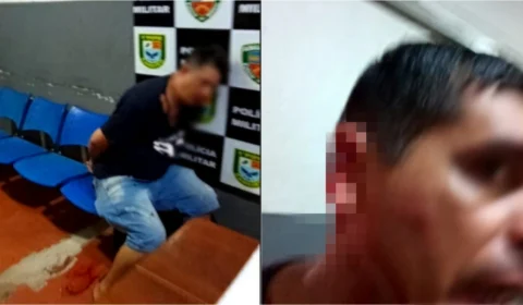 VEJA VÍDEO: policial tem parte da orelha arrancada dentro de quartel no Amazonas
