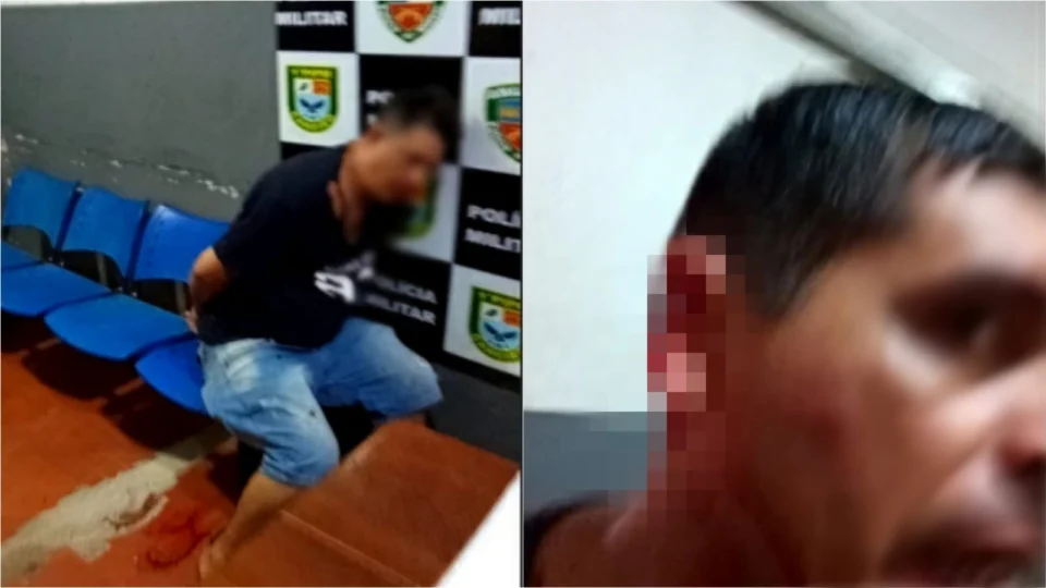 VEJA VÍDEO: policial tem parte da orelha arrancada dentro de quartel no Amazonas