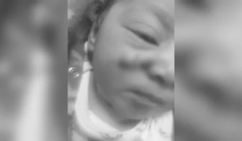 Bebê sofre corte no rosto durante cesárea e família aciona Justiça
