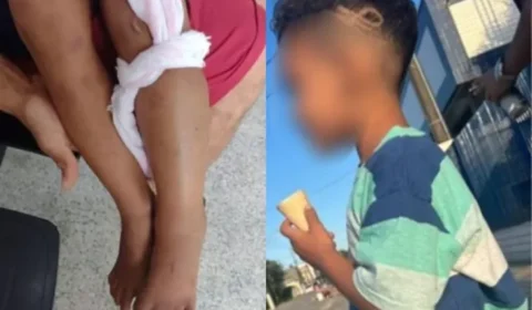 Menino de seis anos é internado na UTI após confundir cobra com galho