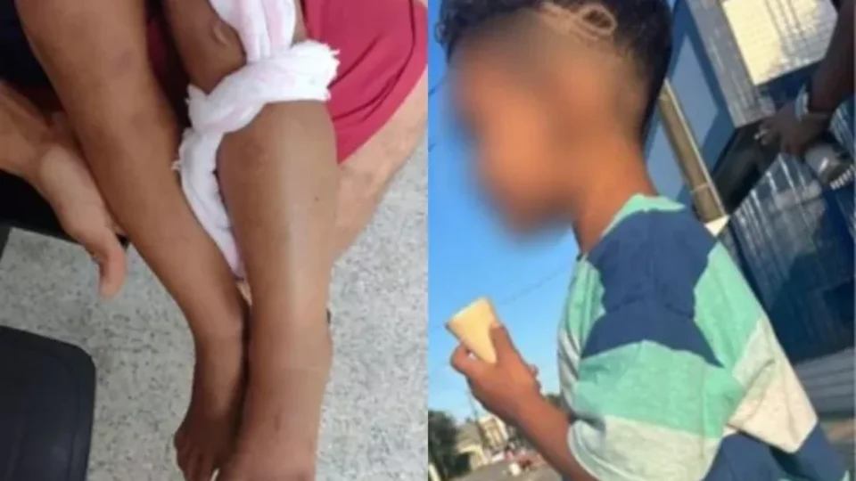 Menino de seis anos é internado na UTI após confundir cobra com galho