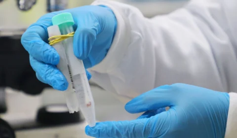 <em>Saúde atualiza boletins da Covid-19, Monkeypox e vacinação no Amazonas nesta sexta-feira</em>