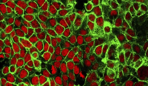 Casos de câncer devem crescer no Brasil; veja lista dos mais comuns