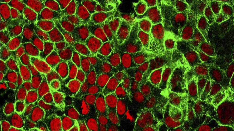 Casos de câncer devem crescer no Brasil; veja lista dos mais comuns