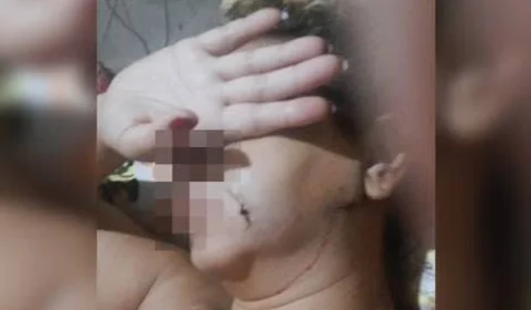 Mulher tem faca cravada no pescoço e ferimento próximo ao coração pelo ex-marido