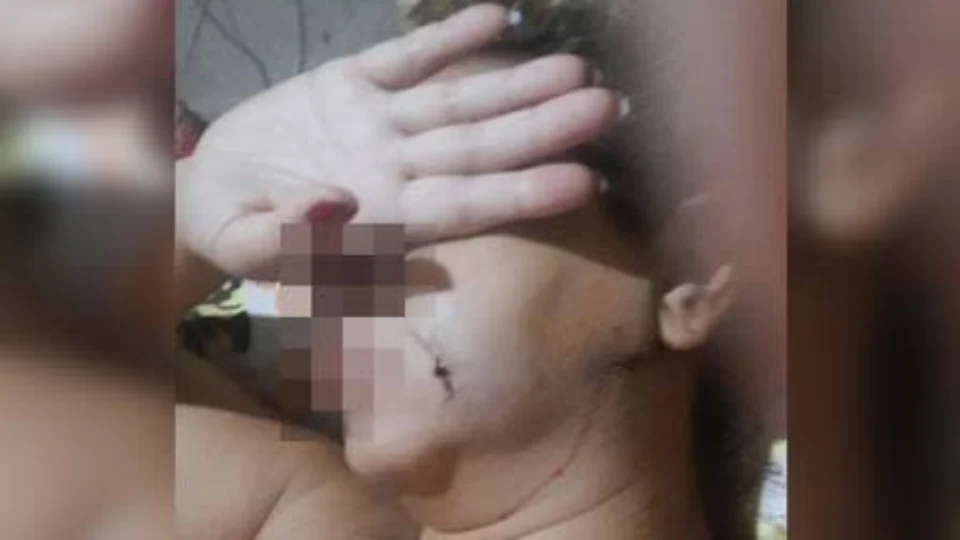 Mulher tem faca cravada no pescoço e ferimento próximo ao coração pelo ex-marido