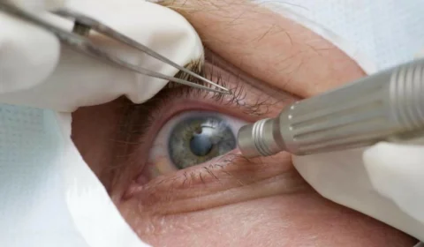 Número de exames oftalmológicos no SUS dobra em relação a 2020