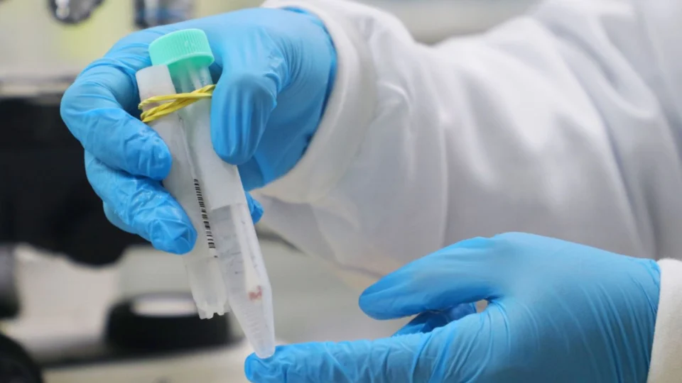 Amazonas registra 65 novos casos de Covid-19