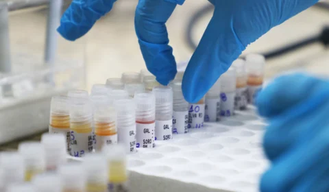 Amazonas registra 12 novos casos de Covid-19