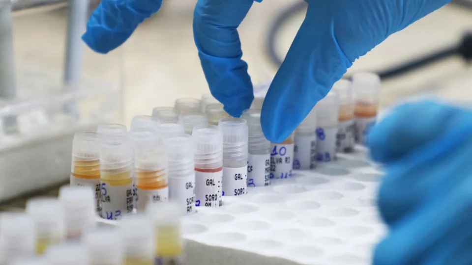 Amazonas registra 12 novos casos de Covid-19