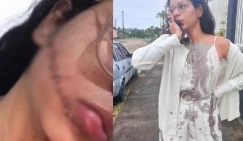 Jovem tem rosto cortado enquanto dormia em viagem de ônibus