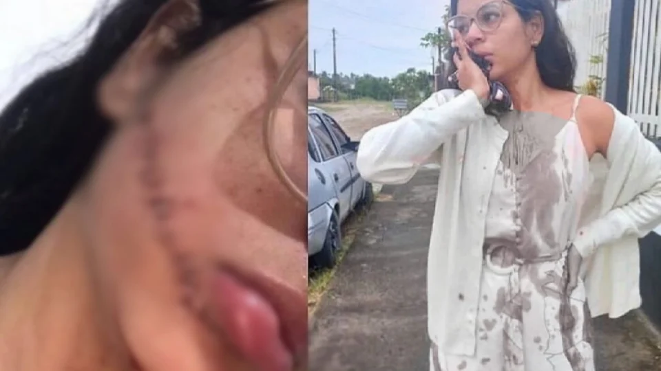 Jovem tem rosto cortado enquanto dormia em viagem de ônibus