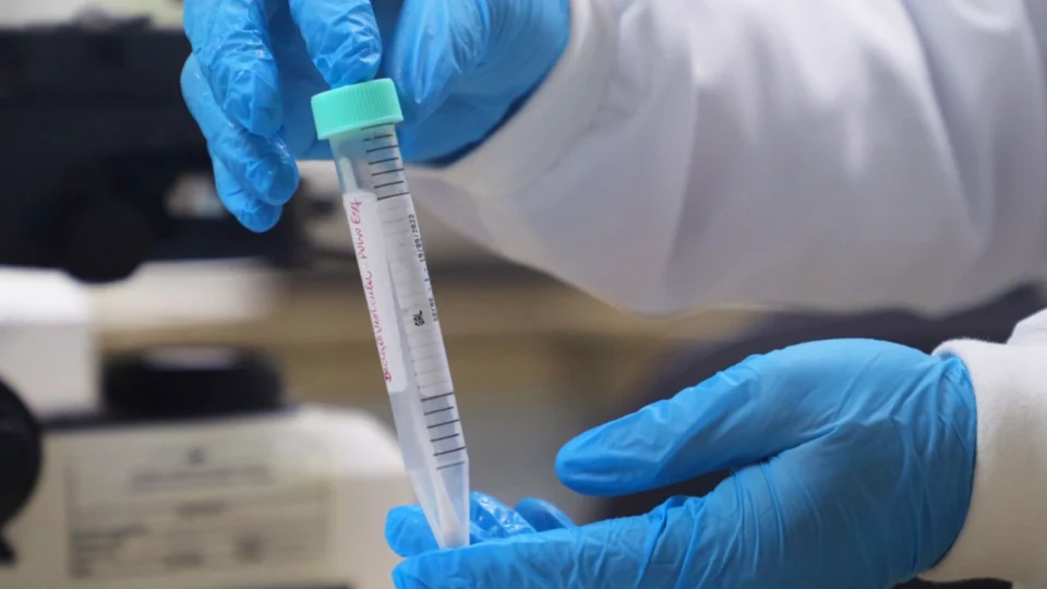 Saúde divulga boletins da Covid-19, Mpox e vacinação no Amazonas nesta sexta-feira