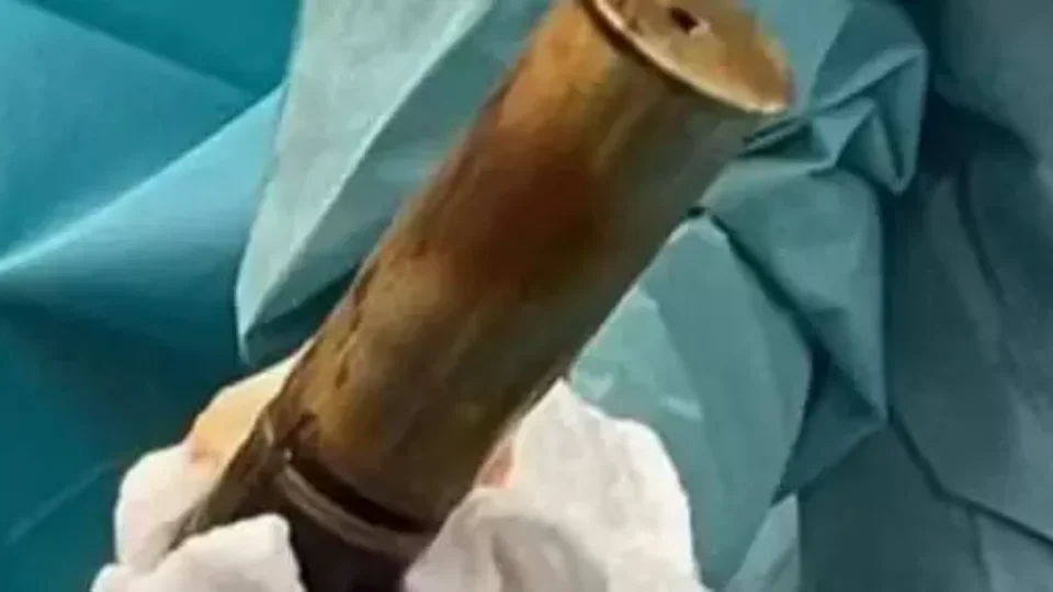 Idoso faz hospital ser evacuado ao chegar com bomba presa no ânus