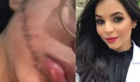 Vídeo mostra passageira se aproximando de jovem que teve rosto cortado