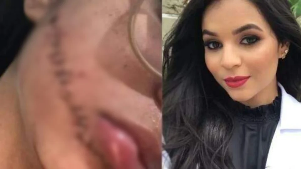 Vídeo mostra passageira se aproximando de jovem que teve rosto cortado