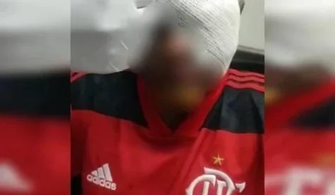 Jovem autista perde olho após ser brutalmente espancado em jogo de futebol