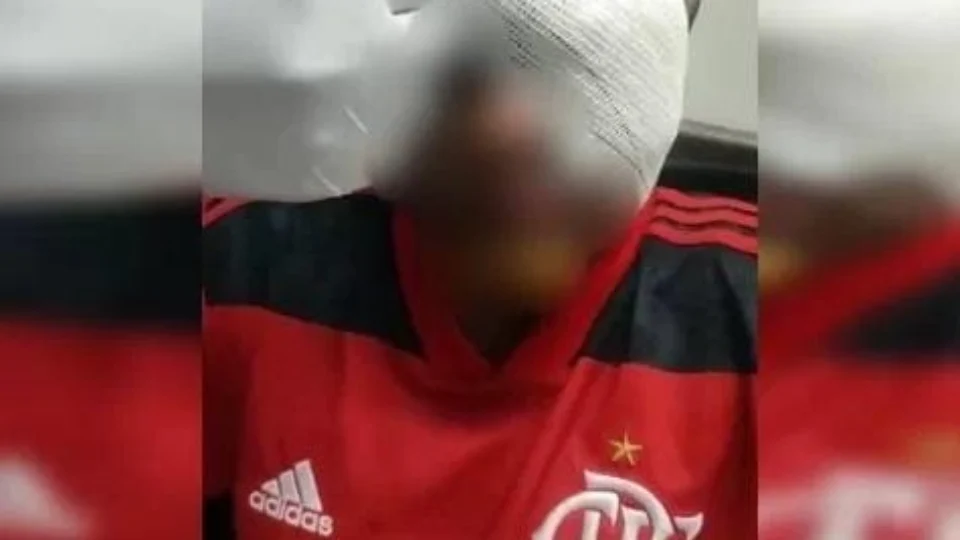 Jovem autista perde olho após ser brutalmente espancado em jogo de futebol