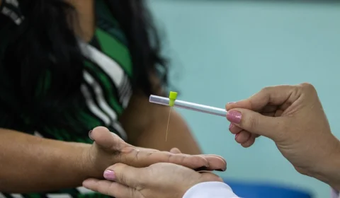 Ação abre campanha Janeiro Roxo contra a hanseníase em Manaus