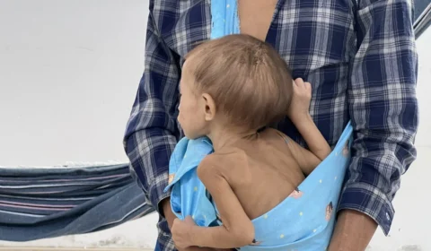 Mãe Yanomami de criança com desnutrição morre em Roraima