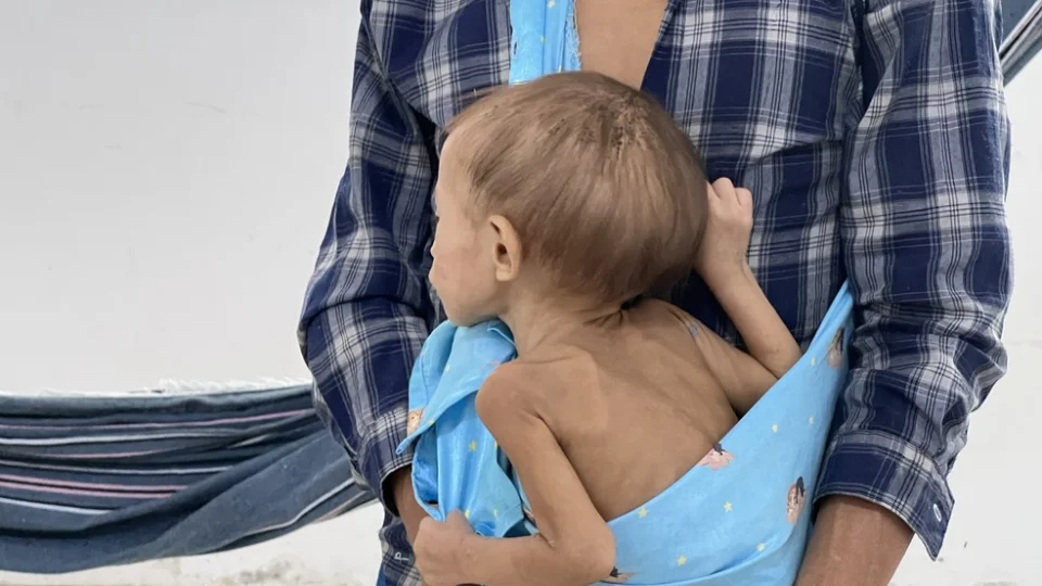 Mãe Yanomami de criança com desnutrição morre em Roraima