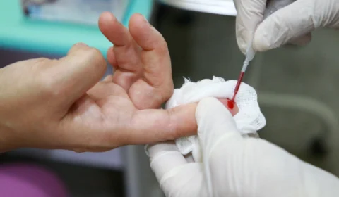 SES-AM acende alerta para população sobre conscientização e prevenção das ISTs