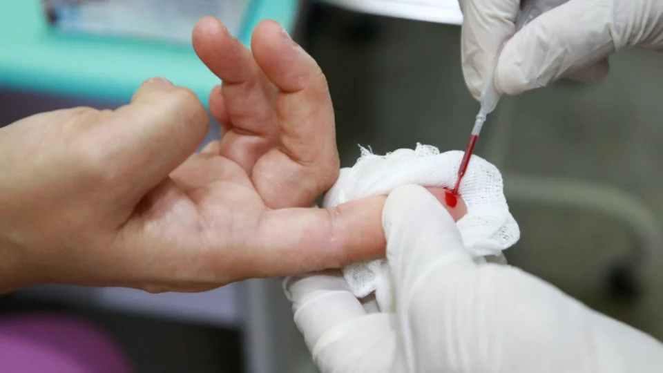 SES-AM acende alerta para população sobre conscientização e prevenção das ISTs