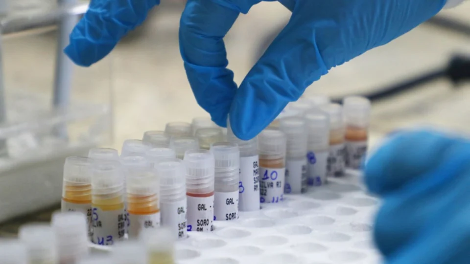 <em>Mpox: Informe semanal atualiza cenário da doença no Amazonas, nesta terça-feira</em>