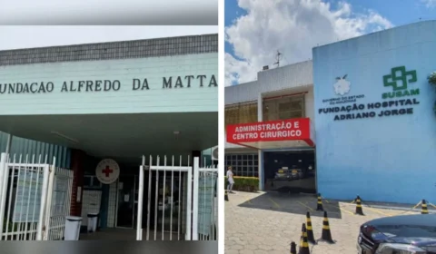 Unidades de Saúde anunciam mutirão de cirurgias dermatológicas